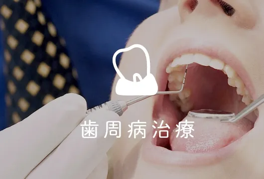 歯周病治療