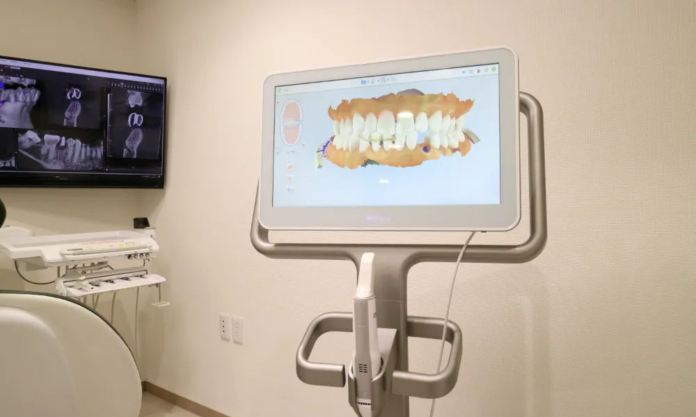 口腔内スキャナー