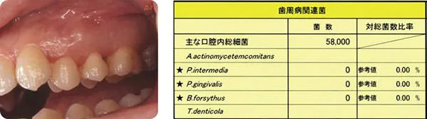 抗菌療法 初期治療終了時